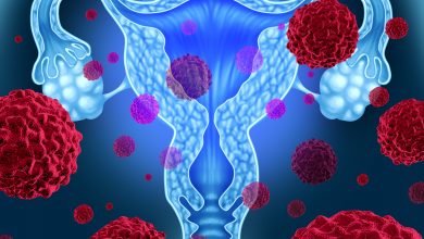 Endometrium Kanser