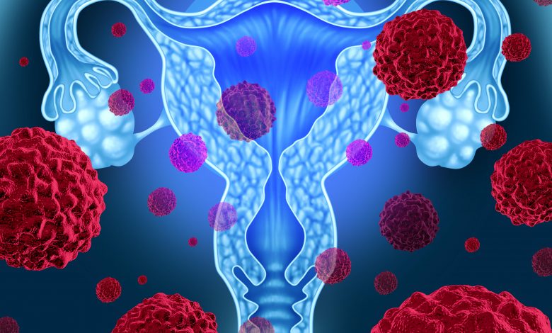 Endometrium Kanser